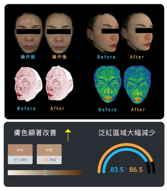 酷雪實證對比圖二